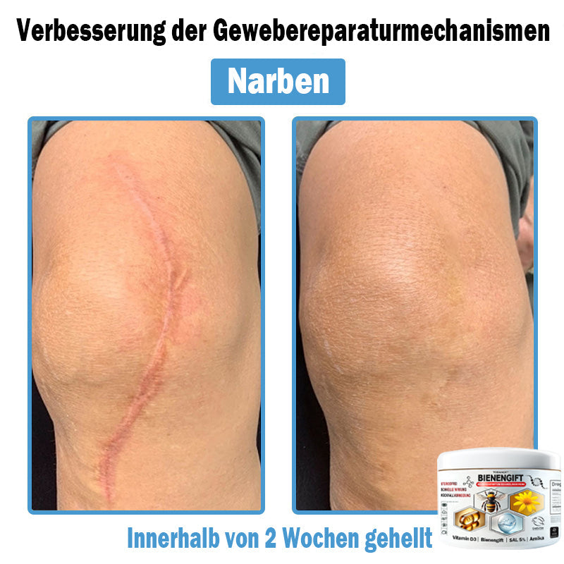 𝐓𝐎𝐃𝑨𝑯𝐎𝐅®🌈 𝑩𝒊𝒆𝒏𝒆𝒏 𝑮𝒊𝒇𝒕 𝑴𝒖𝒍𝒕𝒊𝒔𝒚𝒎𝒑𝒕𝒐𝒎 𝑩𝒆𝒉𝒂𝒏𝒅𝒍𝒖𝒏𝒈𝒔𝒄𝒓𝒆𝒎𝒆 (👨‍⚕𝐃𝐃𝐆 𝐄𝐦𝐩𝐟𝐨𝐡𝐥𝐞𝐧)