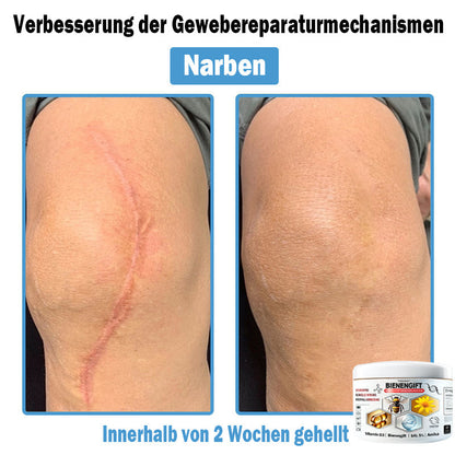 𝐓𝐎𝐃𝑨𝑯𝐎𝐅®🌈 𝑩𝒊𝒆𝒏𝒆𝒏 𝑮𝒊𝒇𝒕 𝑴𝒖𝒍𝒕𝒊𝒔𝒚𝒎𝒑𝒕𝒐𝒎 𝑩𝒆𝒉𝒂𝒏𝒅𝒍𝒖𝒏𝒈𝒔𝒄𝒓𝒆𝒎𝒆 (👨‍⚕𝐃𝐃𝐆 𝐄𝐦𝐩𝐟𝐨𝐡𝐥𝐞𝐧)