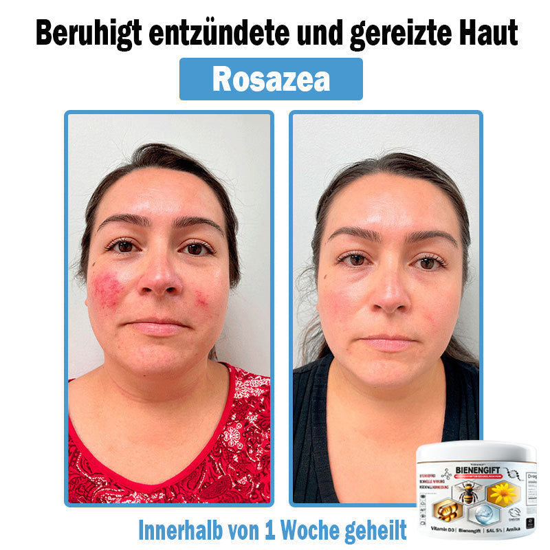 𝐓𝐎𝐃𝑨𝑯𝐎𝐅®🌈 𝑩𝒊𝒆𝒏𝒆𝒏 𝑮𝒊𝒇𝒕 𝑴𝒖𝒍𝒕𝒊𝒔𝒚𝒎𝒑𝒕𝒐𝒎 𝑩𝒆𝒉𝒂𝒏𝒅𝒍𝒖𝒏𝒈𝒔𝒄𝒓𝒆𝒎𝒆 (👨‍⚕𝐃𝐃𝐆 𝐄𝐦𝐩𝐟𝐨𝐡𝐥𝐞𝐧)