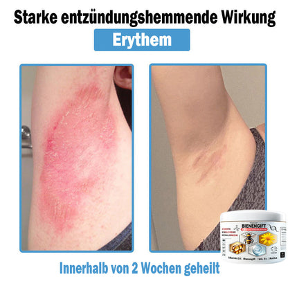 𝐓𝐎𝐃𝑨𝑯𝐎𝐅®🌈 𝑩𝒊𝒆𝒏𝒆𝒏 𝑮𝒊𝒇𝒕 𝑴𝒖𝒍𝒕𝒊𝒔𝒚𝒎𝒑𝒕𝒐𝒎 𝑩𝒆𝒉𝒂𝒏𝒅𝒍𝒖𝒏𝒈𝒔𝒄𝒓𝒆𝒎𝒆 (👨‍⚕𝐃𝐃𝐆 𝐄𝐦𝐩𝐟𝐨𝐡𝐥𝐞𝐧)