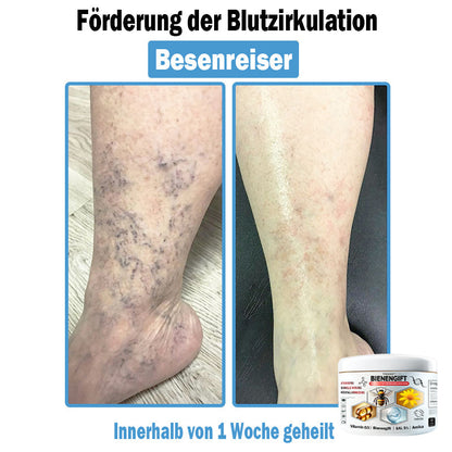 𝐓𝐎𝐃𝑨𝑯𝐎𝐅®🌈 𝑩𝒊𝒆𝒏𝒆𝒏 𝑮𝒊𝒇𝒕 𝑴𝒖𝒍𝒕𝒊𝒔𝒚𝒎𝒑𝒕𝒐𝒎 𝑩𝒆𝒉𝒂𝒏𝒅𝒍𝒖𝒏𝒈𝒔𝒄𝒓𝒆𝒎𝒆 (👨‍⚕𝐃𝐃𝐆 𝐄𝐦𝐩𝐟𝐨𝐡𝐥𝐞𝐧)