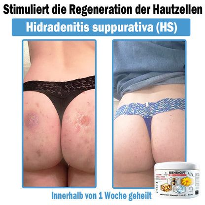 𝐓𝐎𝐃𝑨𝑯𝐎𝐅®🌈 𝑩𝒊𝒆𝒏𝒆𝒏 𝑮𝒊𝒇𝒕 𝑴𝒖𝒍𝒕𝒊𝒔𝒚𝒎𝒑𝒕𝒐𝒎 𝑩𝒆𝒉𝒂𝒏𝒅𝒍𝒖𝒏𝒈𝒔𝒄𝒓𝒆𝒎𝒆 (👨‍⚕𝐃𝐃𝐆 𝐄𝐦𝐩𝐟𝐨𝐡𝐥𝐞𝐧)