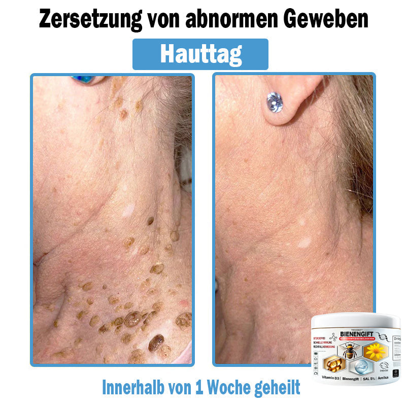 𝐓𝐎𝐃𝑨𝑯𝐎𝐅®🌈 𝑩𝒊𝒆𝒏𝒆𝒏 𝑮𝒊𝒇𝒕 𝑴𝒖𝒍𝒕𝒊𝒔𝒚𝒎𝒑𝒕𝒐𝒎 𝑩𝒆𝒉𝒂𝒏𝒅𝒍𝒖𝒏𝒈𝒔𝒄𝒓𝒆𝒎𝒆 (👨‍⚕𝐃𝐃𝐆 𝐄𝐦𝐩𝐟𝐨𝐡𝐥𝐞𝐧)