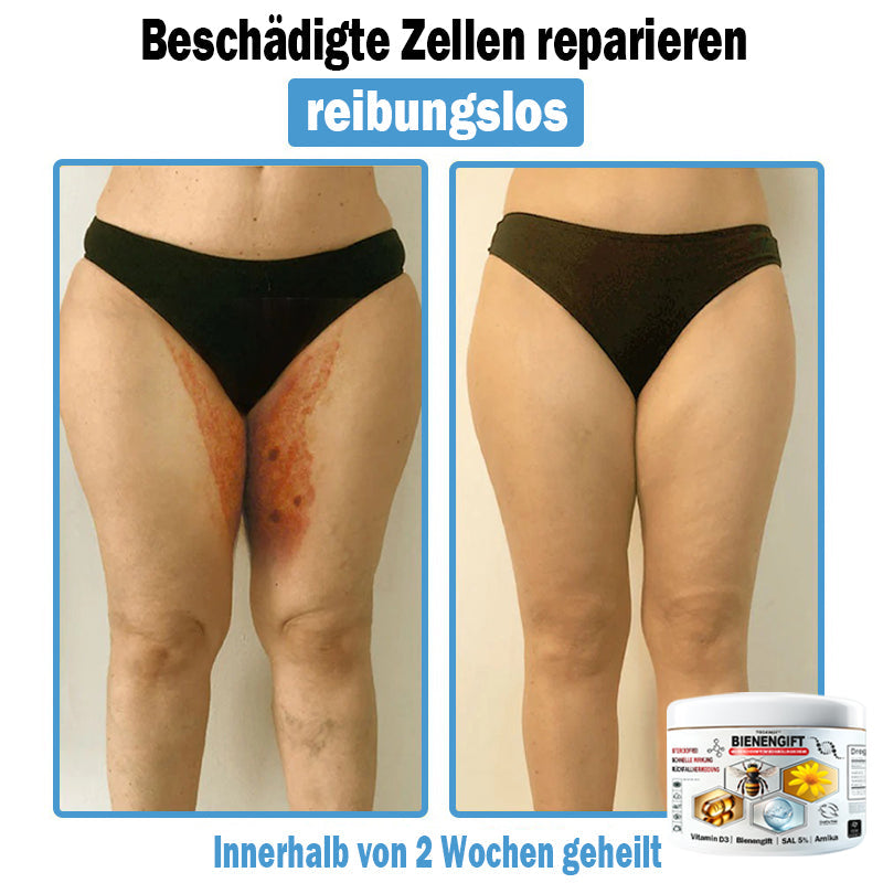 𝐓𝐎𝐃𝑨𝑯𝐎𝐅®🌈 𝑩𝒊𝒆𝒏𝒆𝒏 𝑮𝒊𝒇𝒕 𝑴𝒖𝒍𝒕𝒊𝒔𝒚𝒎𝒑𝒕𝒐𝒎 𝑩𝒆𝒉𝒂𝒏𝒅𝒍𝒖𝒏𝒈𝒔𝒄𝒓𝒆𝒎𝒆 (👨‍⚕𝐃𝐃𝐆 𝐄𝐦𝐩𝐟𝐨𝐡𝐥𝐞𝐧)