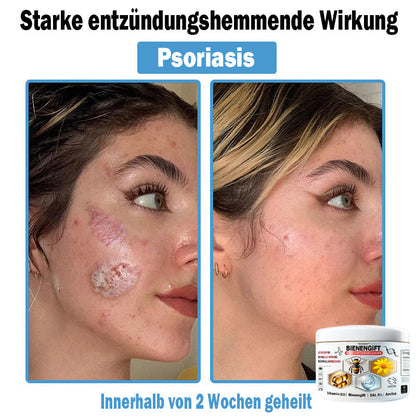 𝐓𝐎𝐃𝑨𝑯𝐎𝐅®🌈 𝑩𝒊𝒆𝒏𝒆𝒏 𝑮𝒊𝒇𝒕 𝑴𝒖𝒍𝒕𝒊𝒔𝒚𝒎𝒑𝒕𝒐𝒎 𝑩𝒆𝒉𝒂𝒏𝒅𝒍𝒖𝒏𝒈𝒔𝒄𝒓𝒆𝒎𝒆 (👨‍⚕𝐃𝐃𝐆 𝐄𝐦𝐩𝐟𝐨𝐡𝐥𝐞𝐧)