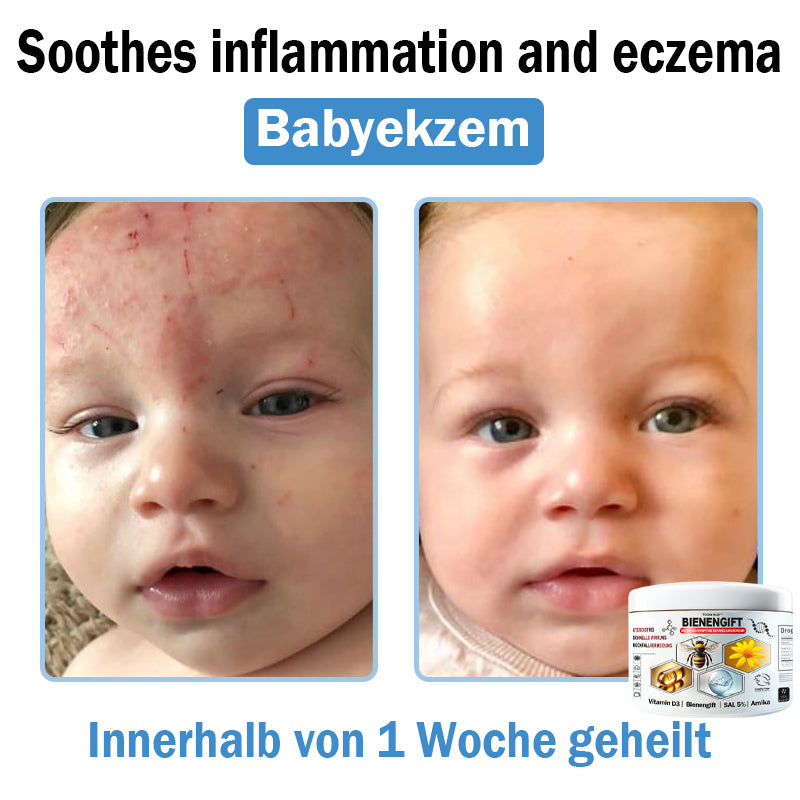 𝐓𝐎𝐃𝑨𝑯𝐎𝐅®🌈 𝑩𝒊𝒆𝒏𝒆𝒏 𝑮𝒊𝒇𝒕 𝑴𝒖𝒍𝒕𝒊𝒔𝒚𝒎𝒑𝒕𝒐𝒎 𝑩𝒆𝒉𝒂𝒏𝒅𝒍𝒖𝒏𝒈𝒔𝒄𝒓𝒆𝒎𝒆 (👨‍⚕𝐃𝐃𝐆 𝐄𝐦𝐩𝐟𝐨𝐡𝐥𝐞𝐧)