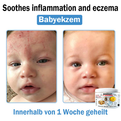 𝐓𝐎𝐃𝑨𝑯𝐎𝐅®🌈 𝑩𝒊𝒆𝒏𝒆𝒏 𝑮𝒊𝒇𝒕 𝑴𝒖𝒍𝒕𝒊𝒔𝒚𝒎𝒑𝒕𝒐𝒎 𝑩𝒆𝒉𝒂𝒏𝒅𝒍𝒖𝒏𝒈𝒔𝒄𝒓𝒆𝒎𝒆 (👨‍⚕𝐃𝐃𝐆 𝐄𝐦𝐩𝐟𝐨𝐡𝐥𝐞𝐧)